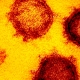 Covid-19 (Coronavirus) microscopic image