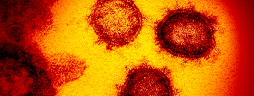Covid-19 (Coronavirus) microscopic image